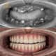 Slider image (9) WinSmile Dental Clinic Vietnam